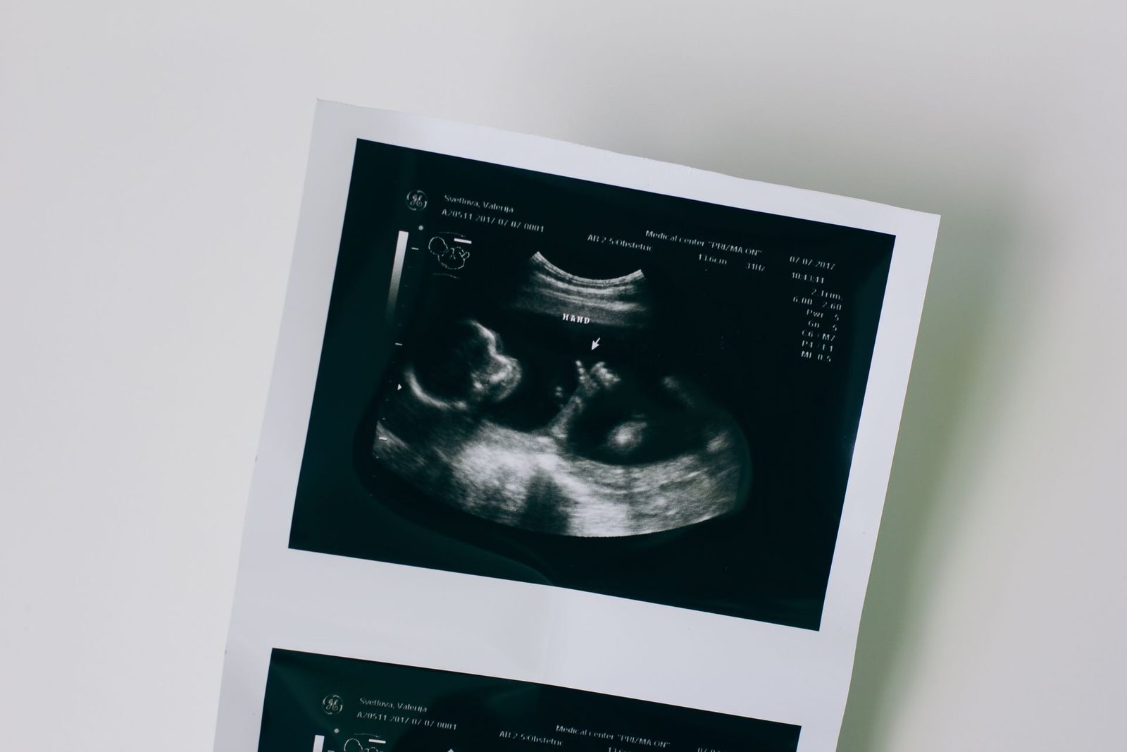 embryo