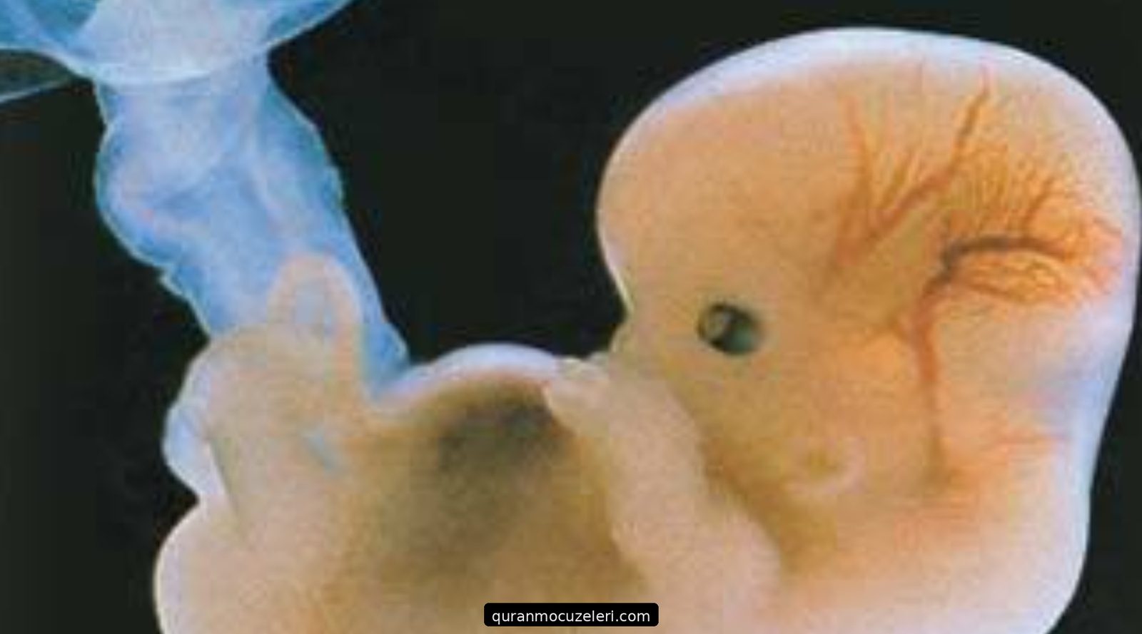 embryo