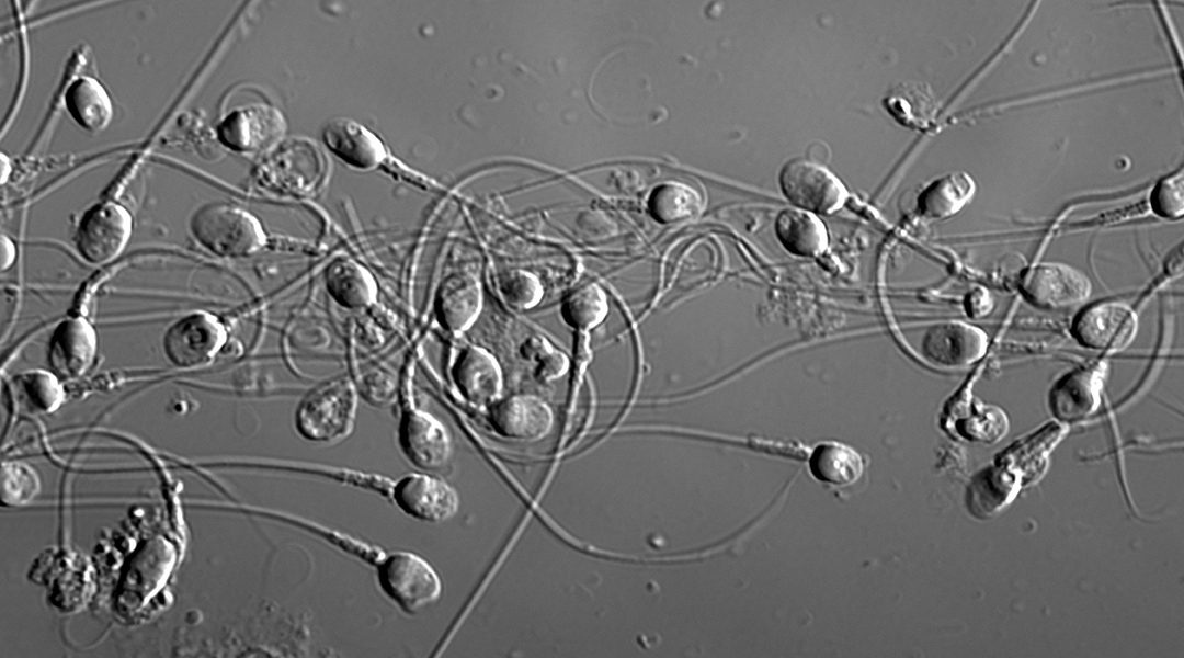 sperm